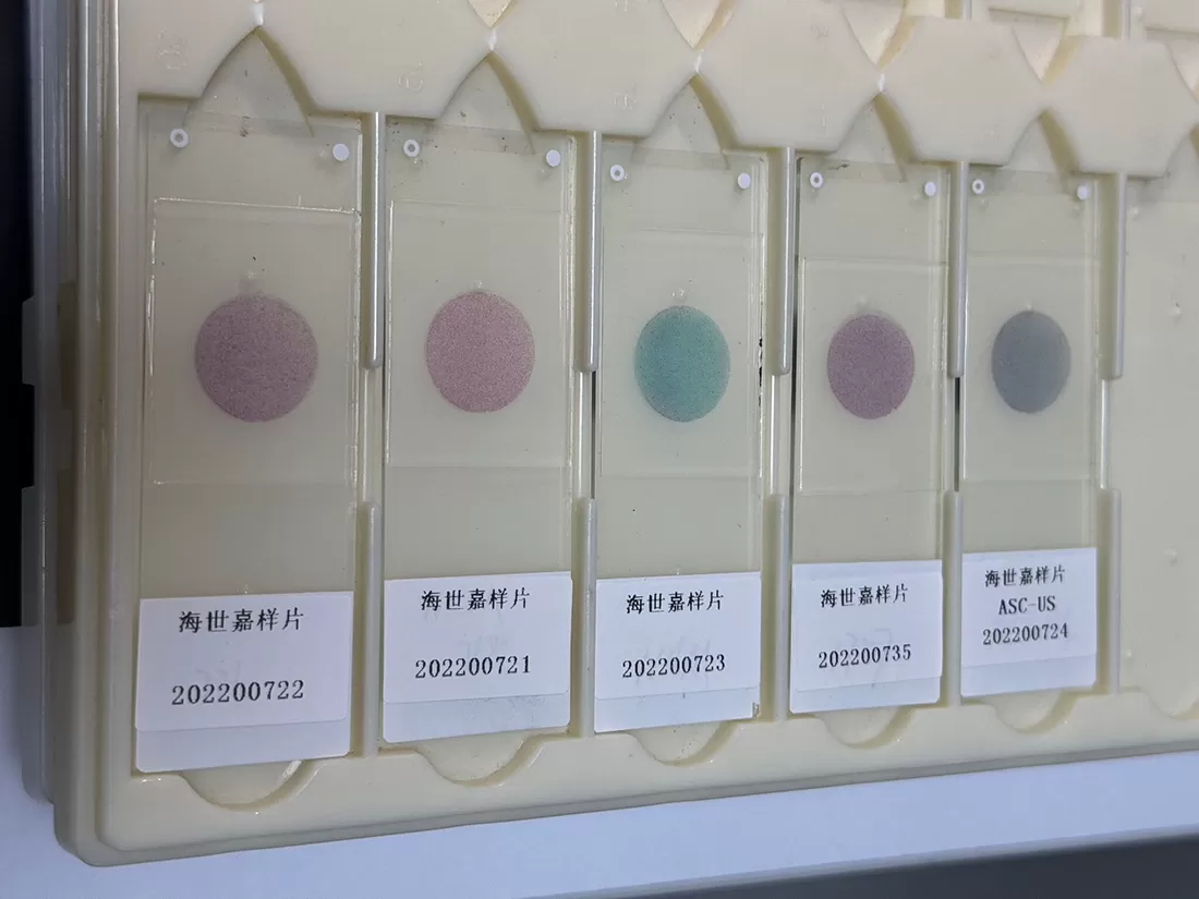 パップ染色の結果を正しく解釈する方法